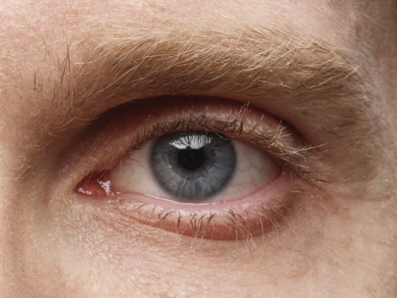 open eye