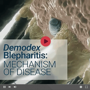 An Overview of <em>Demodex</em> blepharitis